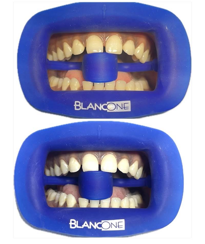Happy Kid Dental Clinic | Children Dentist | Orthodontics & Tongue Tie Center